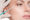 Restylane Injections
